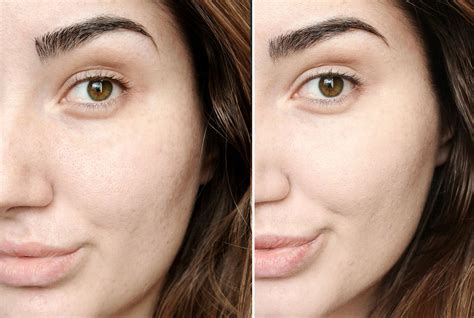 chanel foundation best|chanel foundation before and after.